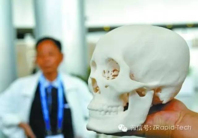 First 3D printing skull in China attracted onlookers